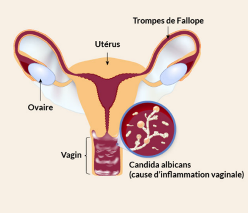 Contre Candida albicans : Quand Levure Et Bactéries Unissent Leurs Forces